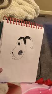 Hyperpigmentation Meme, Explained